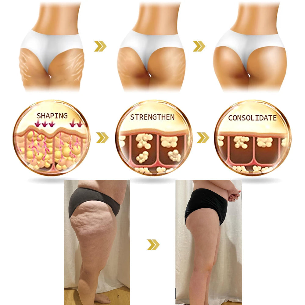 ✨💖Flysmus® Skin Firming Cream,Addressing Crepe & Sagging