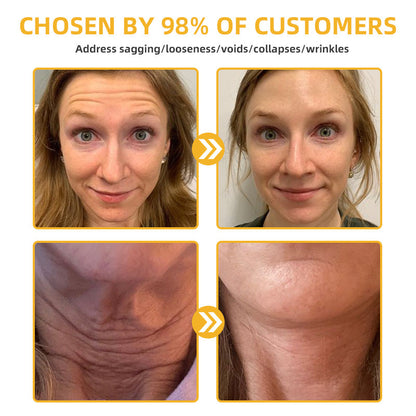 💐🥇Flysmus™ BeeLift Anti-Aging Firming Cream,Address Crepe & Sagging(🔥74% Off for a Limited Time!)