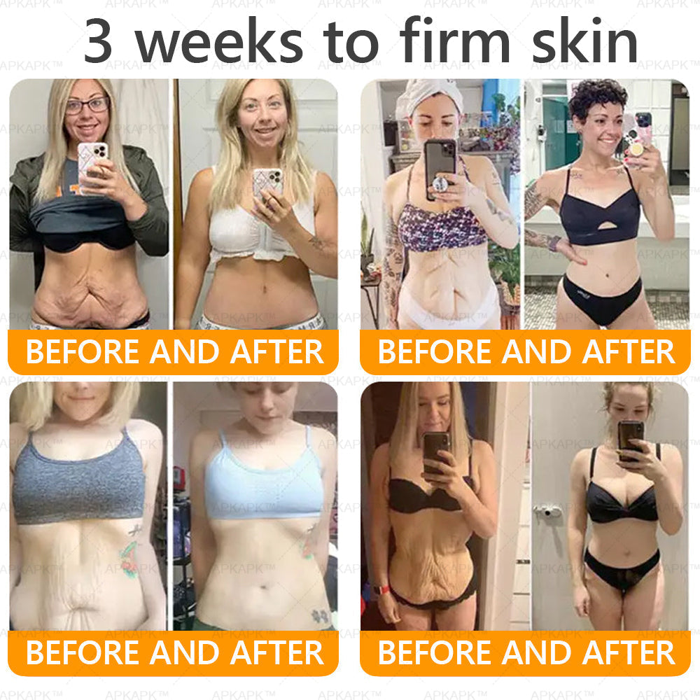 Made and Shipped from USA 💎 APKAPK® Bee venom Comprehensive Cream 🔥 LAST DAY 80% OFF 💎