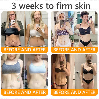 Made and Shipped from USA 💎 APKAPK® Bee venom Comprehensive Cream 🔥 LAST DAY 80% OFF 💎