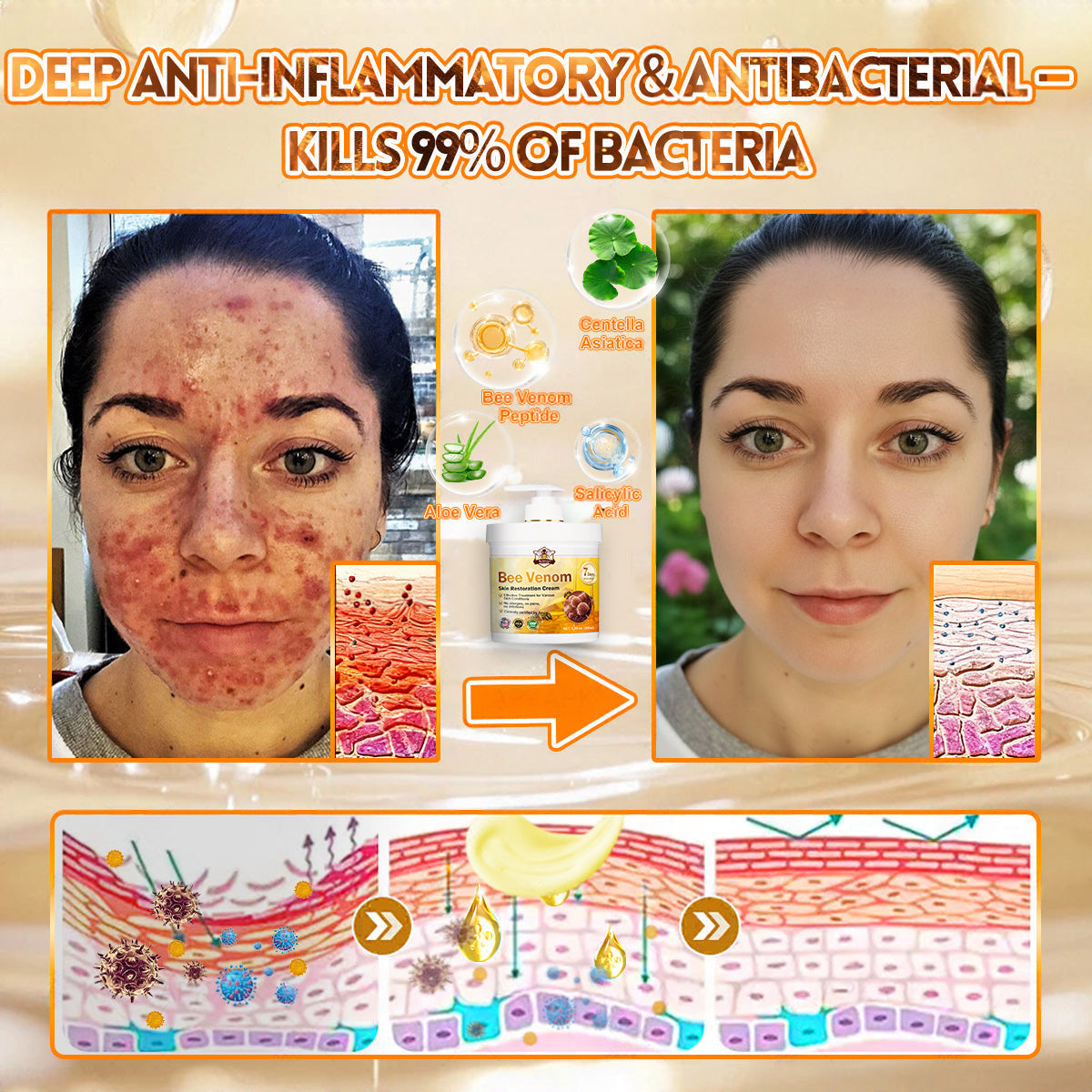 🐝💖FDA Approved|Rolimey® Bee Venom Skin Restoration Cream (Anti-aging, Hydrating, Skin Repair, Even Tone, Acne and Dark Spot Treatment, Wart and Mole Removal, Psoriasis Relief)