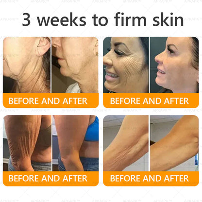 Made and Shipped from USA 💎 APKAPK® Bee venom Comprehensive Cream 🔥 LAST DAY 80% OFF 💎