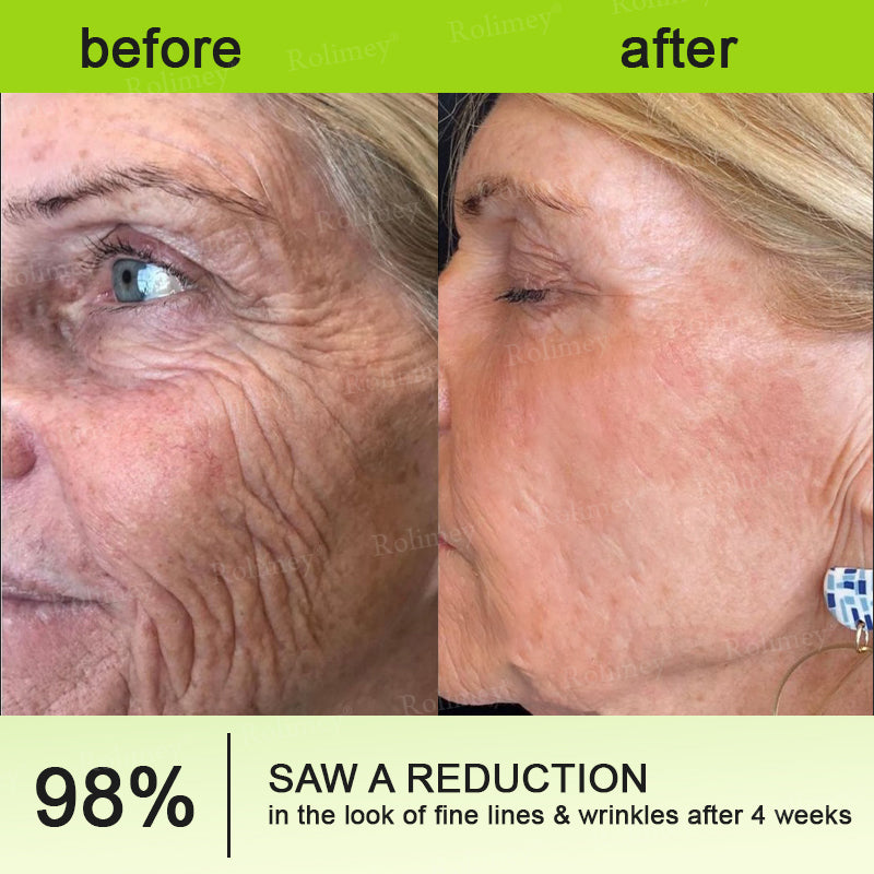 Made and shipped from the USA 💫Rolimey® Botox & Vita-A Retinol Shot Wrinkle-Lift Tightening cream - Last Day Promotion 70% OFF