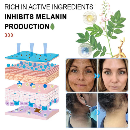 🍀Furzero™️ Quarxery Purifying Enzymes Exfoliating Gel (Also Cure Acanthosis Nigricans)💟