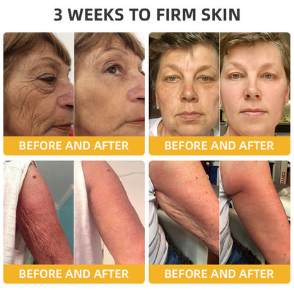 💐🥇Flysmus™ BeeLift Anti-Aging Firming Cream,Address Crepe & Sagging(🔥74% Off for a Limited Time!)