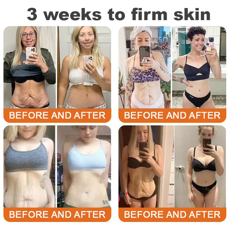 💫👨‍⚕️🐬Made and Shipped from the USA✨Flysmus™ Botox Bee Venom Firming Serum Stick🔥LAST DAY 70% OFF