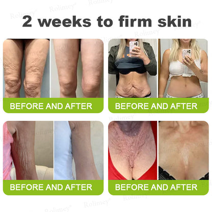 Made and shipped from the USA 💫Rolimey® Botox & Vita-A Retinol Shot Wrinkle-Lift Tightening cream - Last Day Promotion 70% OFF