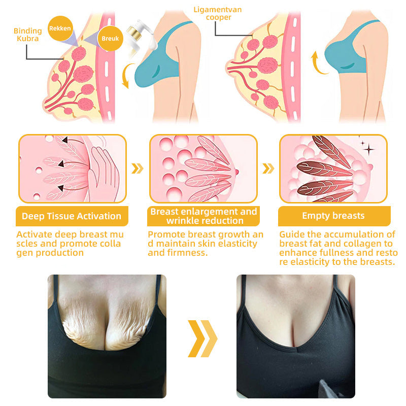 💐🥇Flysmus™ BeeLift Anti-Aging Firming Cream,Address Crepe & Sagging(🔥74% Off for a Limited Time!)