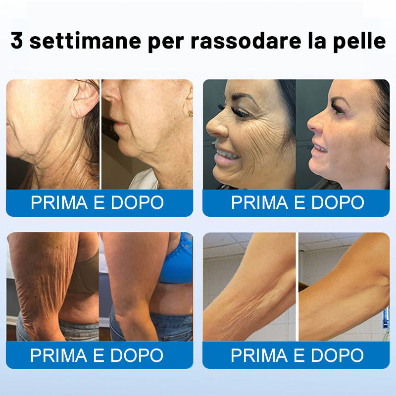 ✨✨Furzero® Oligopeptide-Infused Skin Firming Cream