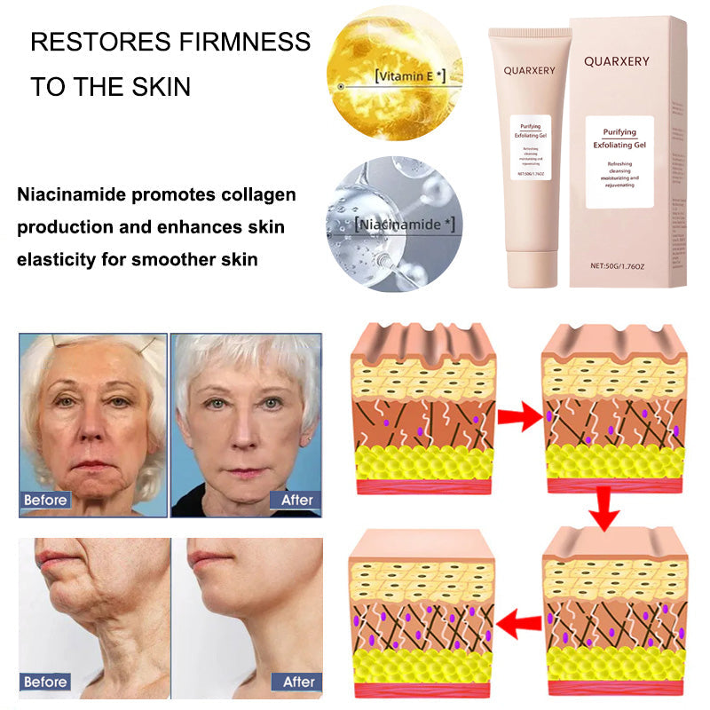 🍀Furzero™️ Quarxery Purifying Enzymes Exfoliating Gel (Also Cure Acanthosis Nigricans)💟