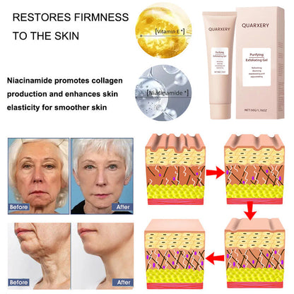 🍀Furzero™️ Quarxery Purifying Enzymes Exfoliating Gel (Also Cure Acanthosis Nigricans)💟