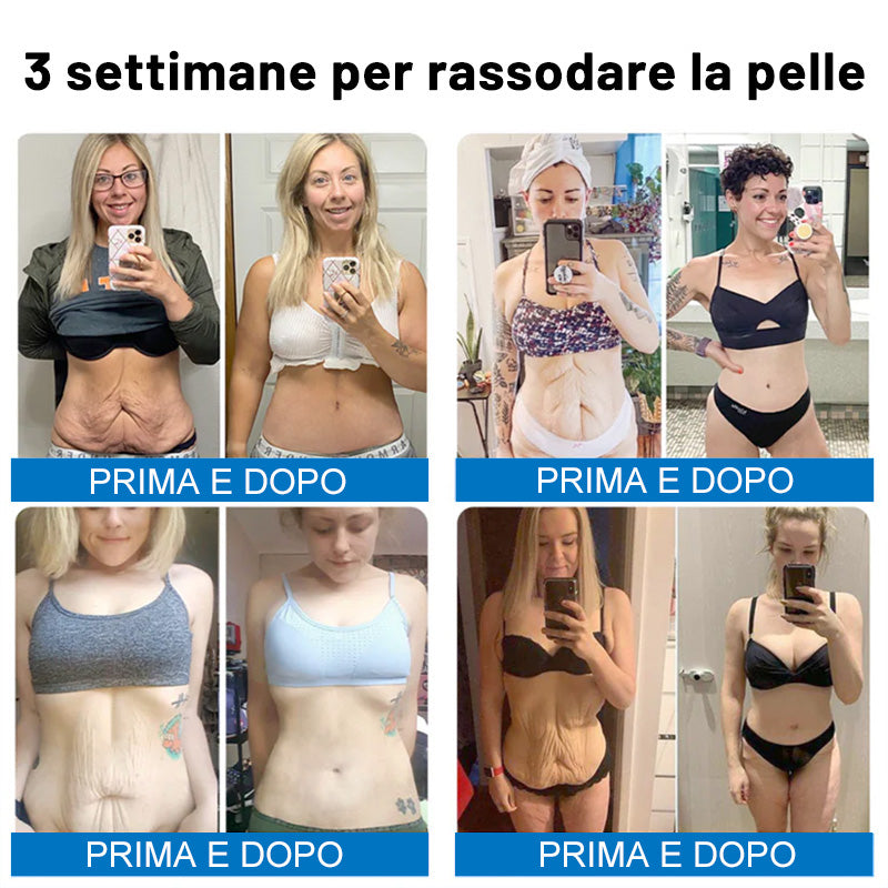 ✨✨Furzero® Oligopeptide-Infused Skin Firming Cream