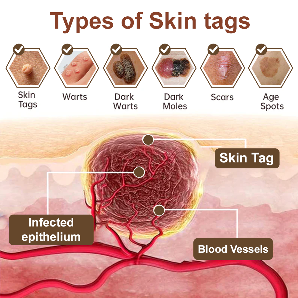 Celsiora® Black Rice Skin Repair Essence Cream ⚕️ FDA Certified (Removes warts and skin growths, improves keratin buildup and seborrheic dermatitis, follicular keratosis, age spots, and bruising)