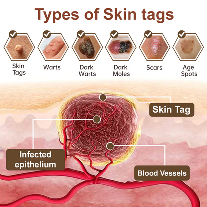 Celsiora® Black Rice Skin Repair Essence Cream ⚕️ FDA Certified (Removes warts and skin growths, improves keratin buildup and seborrheic dermatitis, follicular keratosis, age spots, and bruising)