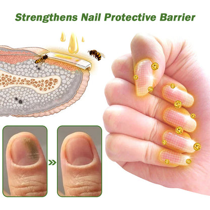 Furzero™ Nail Defense Bee Venom Treatment Serum (For All Kinds Of Nail Diseases-For Healthier Nail Growth)