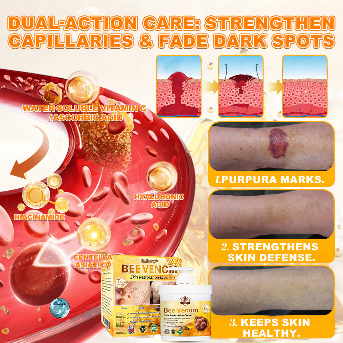 🐝💖FDA Approved|Rolimey® Bee Venom Skin Restoration Cream (Anti-aging, Hydrating, Skin Repair, Even Tone, Acne and Dark Spot Treatment, Wart and Mole Removal, Psoriasis Relief)