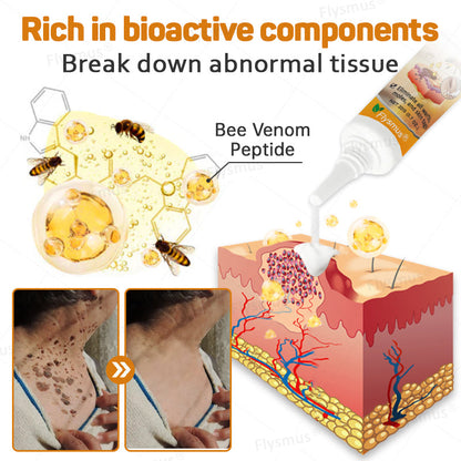 Flysmus® Tag Recede Bee Venom Treatment Cream-LAST DAY 70% OFF-Maximize Skin Renewal
