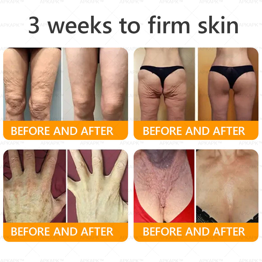 Made and Shipped from USA 💎 APKAPK® Bee venom Comprehensive Cream 🔥 LAST DAY 80% OFF 💎