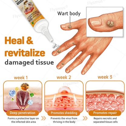 Flysmus® Tag Recede Bee Venom Treatment Cream-LAST DAY 70% OFF-Maximize Skin Renewal