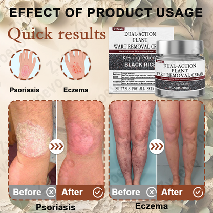 Celsiora® Black Rice Skin Repair Essence Cream ⚕️ FDA Certified (Removes warts and skin growths, improves keratin buildup and seborrheic dermatitis, follicular keratosis, age spots, and bruising) upsell