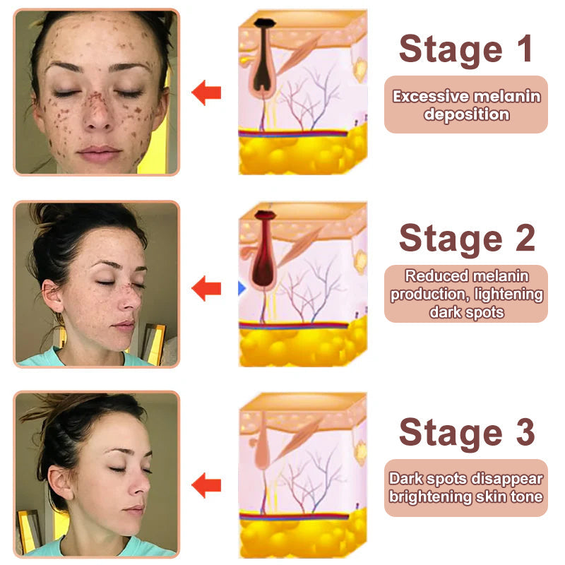 🍀Furzero™️ Quarxery Purifying Enzymes Exfoliating Gel (Also Cure Acanthosis Nigricans)💟