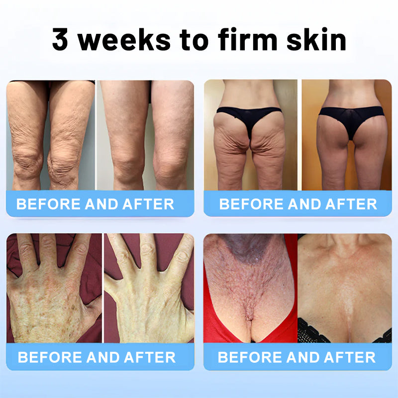 🔥🥔Flysmus™ Collagen Peptides FIRMING SERUM