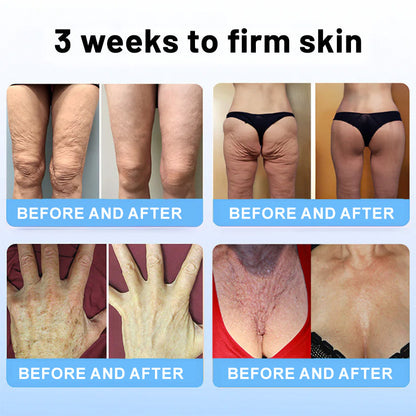 🔥🥔Flysmus™ Collagen Peptides FIRMING SERUM