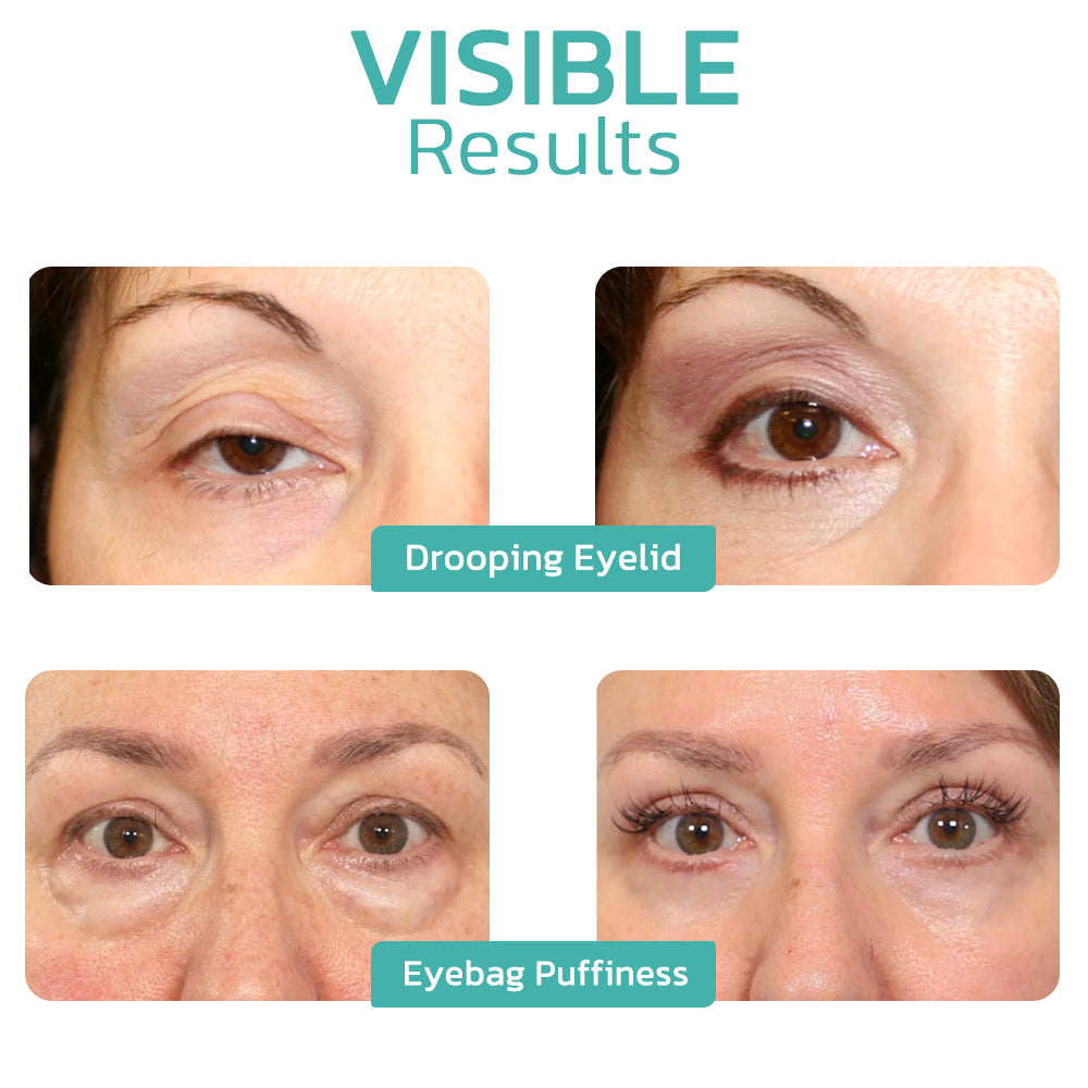 👩‍⚕️🌾Furzero™ CELYN Peptide Taut Eye Cream