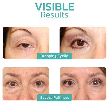 👩‍⚕️🌾Furzero™ CELYN Peptide Taut Eye Cream