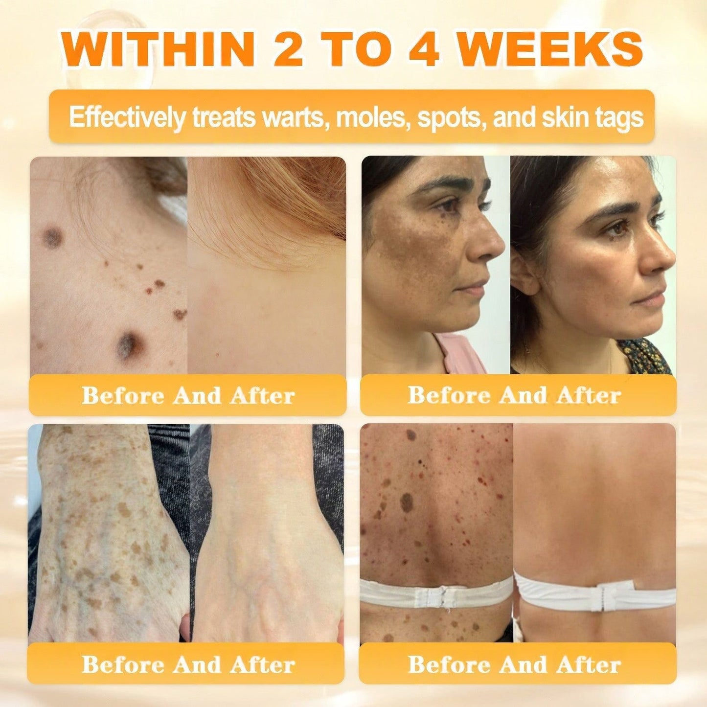 🐝💖FDA Approved|Rolimey® Bee Venom Skin Restoration Cream (Anti-aging, Hydrating, Skin Repair, Even Tone, Acne and Dark Spot Treatment, Wart and Mole Removal, Psoriasis Relief)