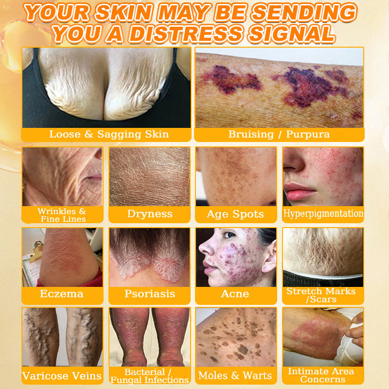 🐝💖FDA Approved|Rolimey® Bee Venom Skin Restoration Cream (Anti-aging, Hydrating, Skin Repair, Even Tone, Acne and Dark Spot Treatment, Wart and Mole Removal, Psoriasis Relief)