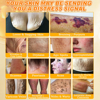 🐝💖FDA Approved|Rolimey® Bee Venom Skin Restoration Cream (Anti-aging, Hydrating, Skin Repair, Even Tone, Acne and Dark Spot Treatment, Wart and Mole Removal, Psoriasis Relief)