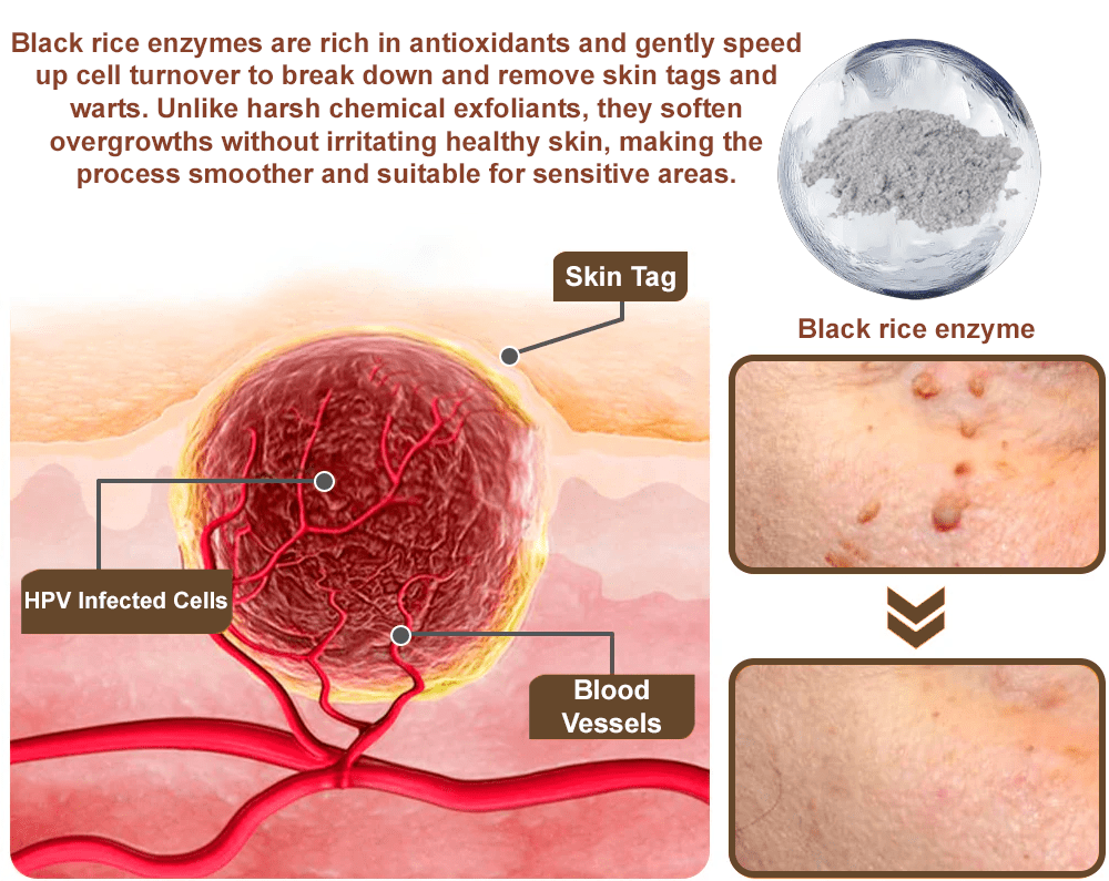 Celsiora® Black Rice Skin Repair Essence Cream ⚕️ FDA Certified (Removes warts and skin growths, improves keratin buildup and seborrheic dermatitis, follicular keratosis, age spots, and bruising) upsell - cikryna