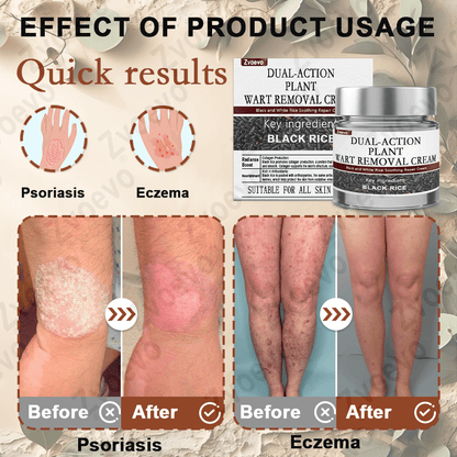 Celsiora® Black Rice Skin Repair Essence Cream ⚕️ FDA Certified (Removes warts and skin growths, improves keratin buildup and seborrheic dermatitis, follicular keratosis, age spots, and bruising) upsell - cikryna