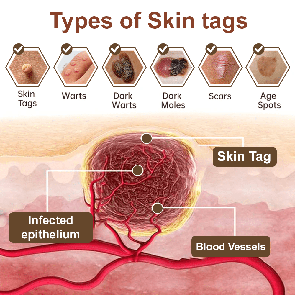 Celsiora® Black Rice Skin Repair Essence Cream ⚕️ FDA Certified (Removes warts and skin growths, improves keratin buildup and seborrheic dermatitis, follicular keratosis, age spots, and bruising) upsell - cikryna