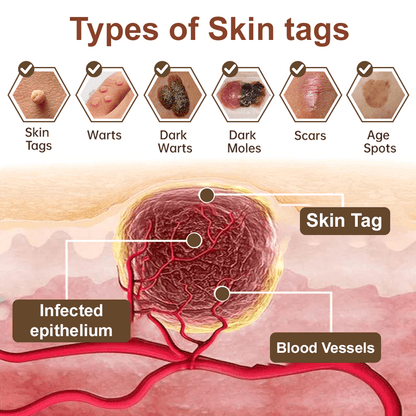 Celsiora® Black Rice Skin Repair Essence Cream ⚕️ FDA Certified (Removes warts and skin growths, improves keratin buildup and seborrheic dermatitis, follicular keratosis, age spots, and bruising) upsell - cikryna