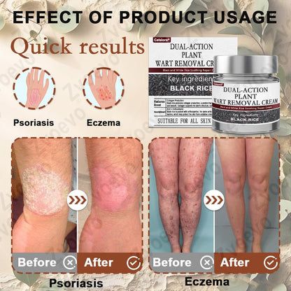 Celsiora® Black Rice Skin Repair Essence Cream ⚕️ FDA Certified (Removes warts and skin growths, improves keratin buildup and seborrheic dermatitis, follicular keratosis, age spots, and bruising) upsell - cikryna