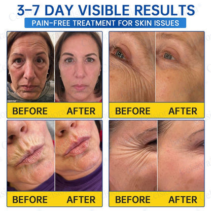 ✨🧩Celsiora® PDRN Anti-Wrinkle Shot – Lift & Firming Cream upsell - cikryna