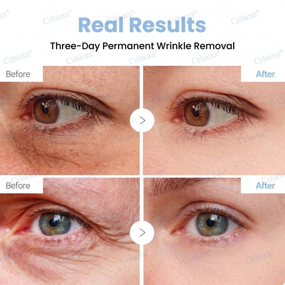 ✨🧩Celsiora® PDRN Anti-Wrinkle Shot – Lift & Firming Cream upsell - cikryna