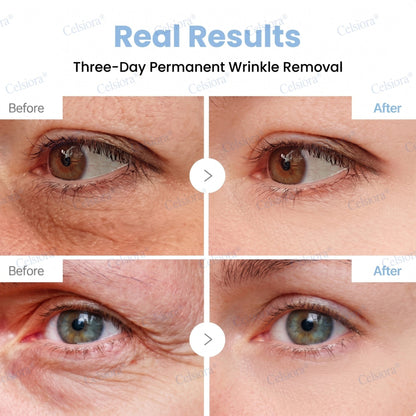 ✨🧩Celsiora® PDRN Anti-Wrinkle Shot – Lift & Firming Cream upsell - cikryna