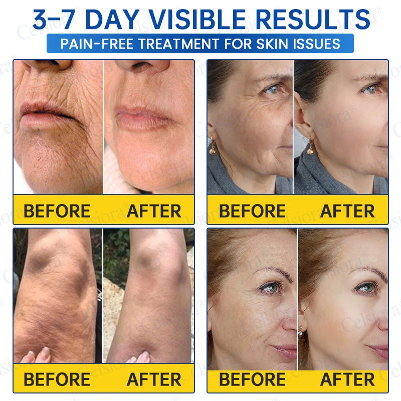 ✨🧩Celsiora® PDRN Anti-Wrinkle Shot – Lift & Firming Cream upsell - cikryna
