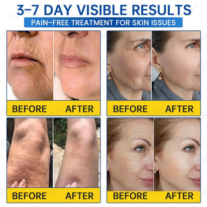 ✨🧩Celsiora® PDRN Anti-Wrinkle Shot – Lift & Firming Cream upsell - cikryna