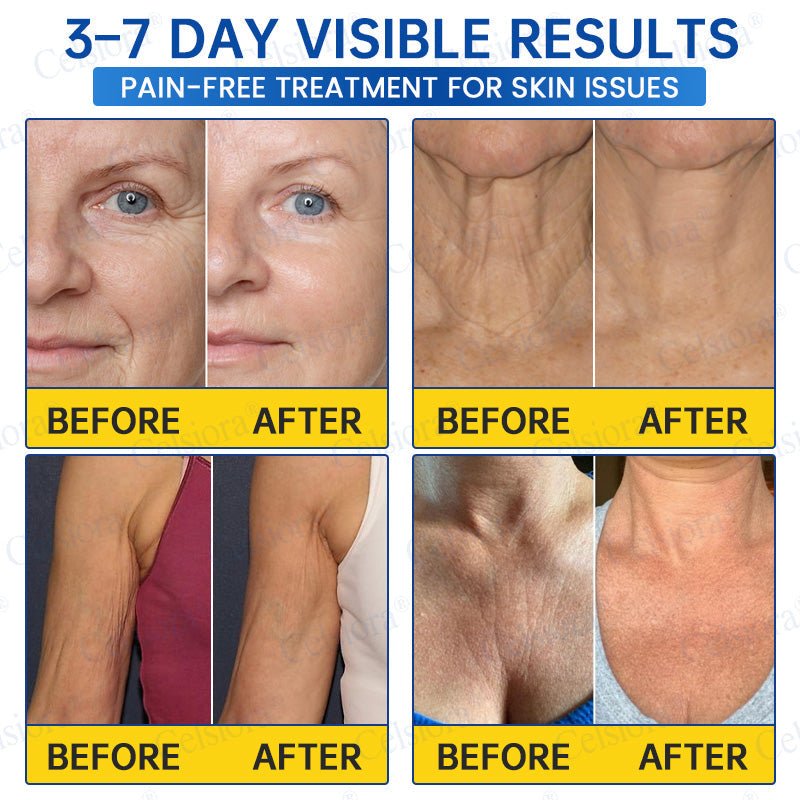 ✨🧩Celsiora® PDRN Anti-Wrinkle Shot – Lift & Firming Cream upsell - cikryna