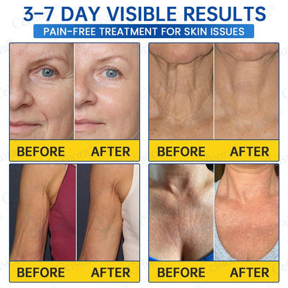 ✨🧩Celsiora® PDRN Anti-Wrinkle Shot – Lift & Firming Cream upsell - cikryna