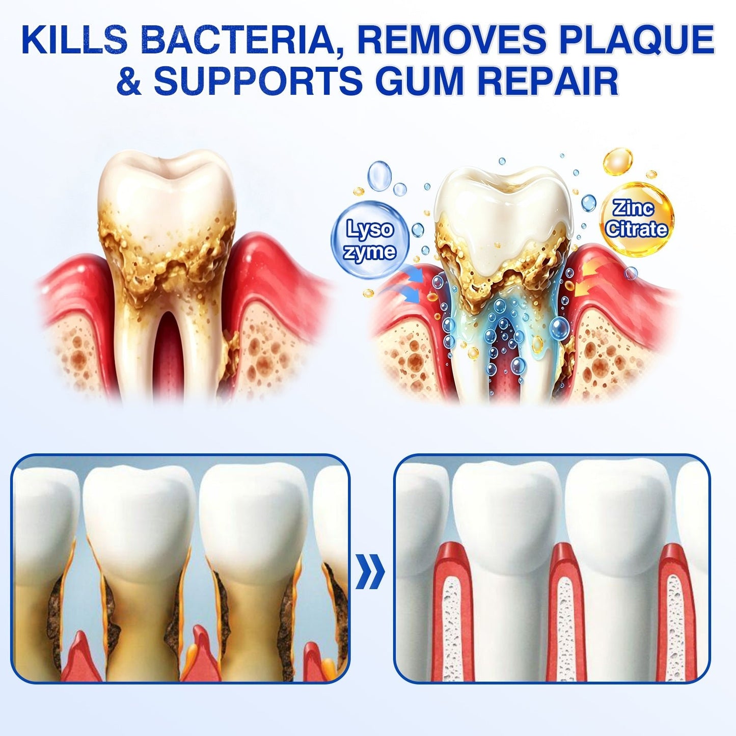 🇺🇸🏆🦷🛡️Evolvion® GumRevive Periodontal Repair Gel upsell - cikryna