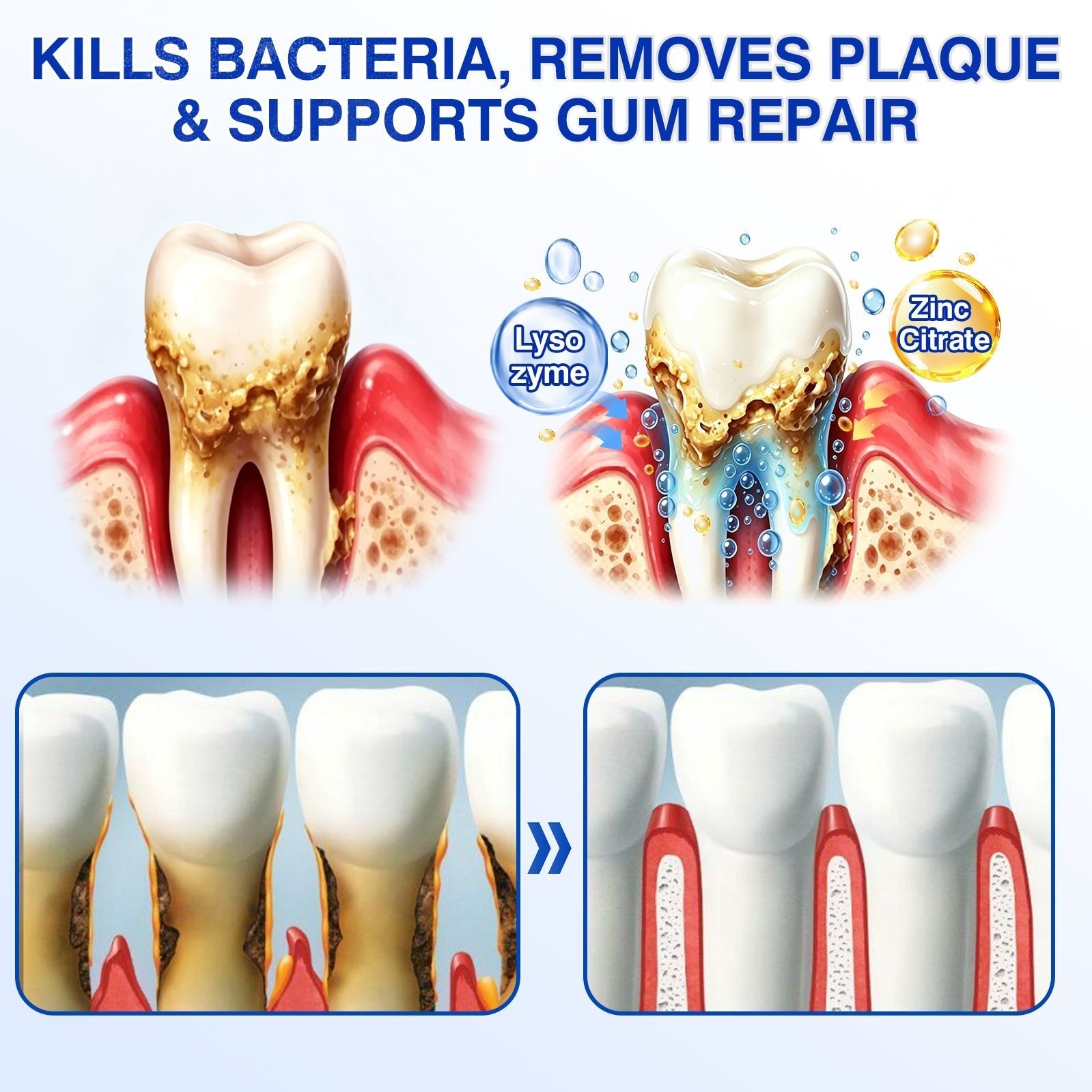 🇺🇸🏆🦷🛡️Evolvion® GumRevive Periodontal Repair Gel upsell - cikryna