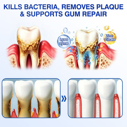 🇺🇸🏆🦷🛡️Evolvion® GumRevive Periodontal Repair Gel upsell - cikryna