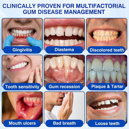 🇺🇸🏆🦷🛡️Evolvion® GumRevive Periodontal Repair Gel upsell - cikryna