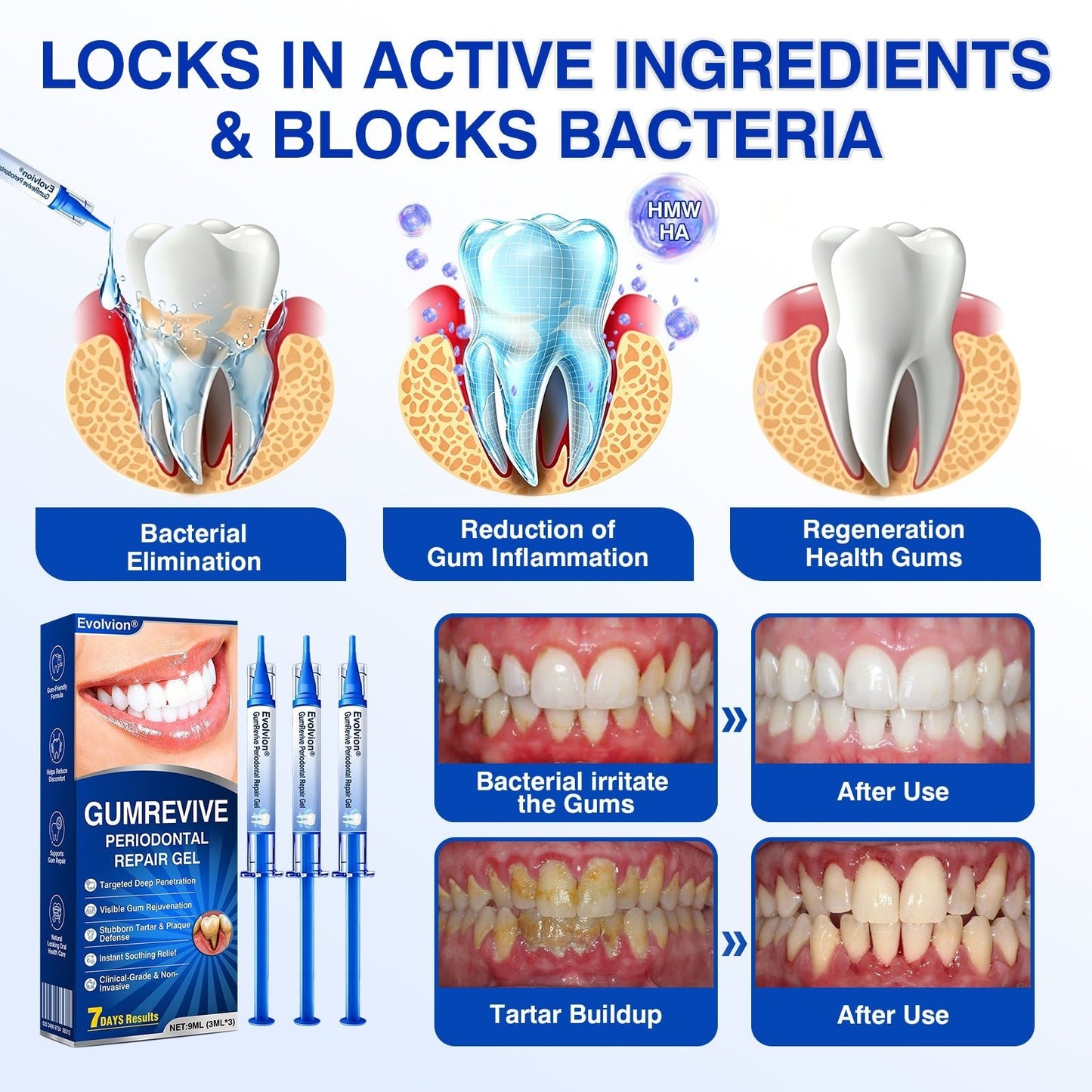 🇺🇸🏆🦷🛡️Evolvion® GumRevive Periodontal Repair Gel upsell - cikryna