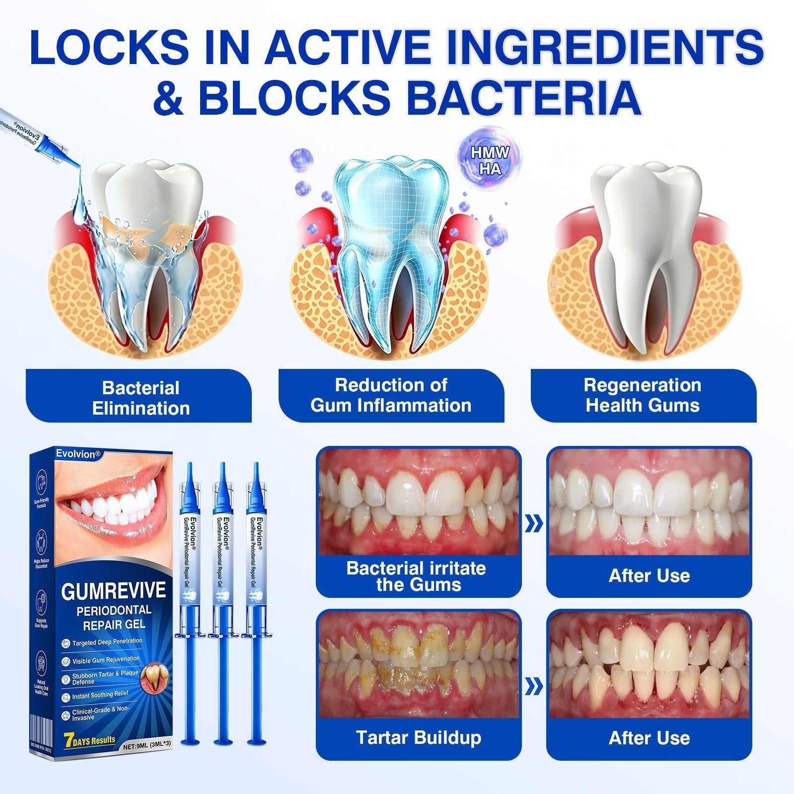 🇺🇸🏆🦷🛡️Evolvion® GumRevive Periodontal Repair Gel upsell - cikryna